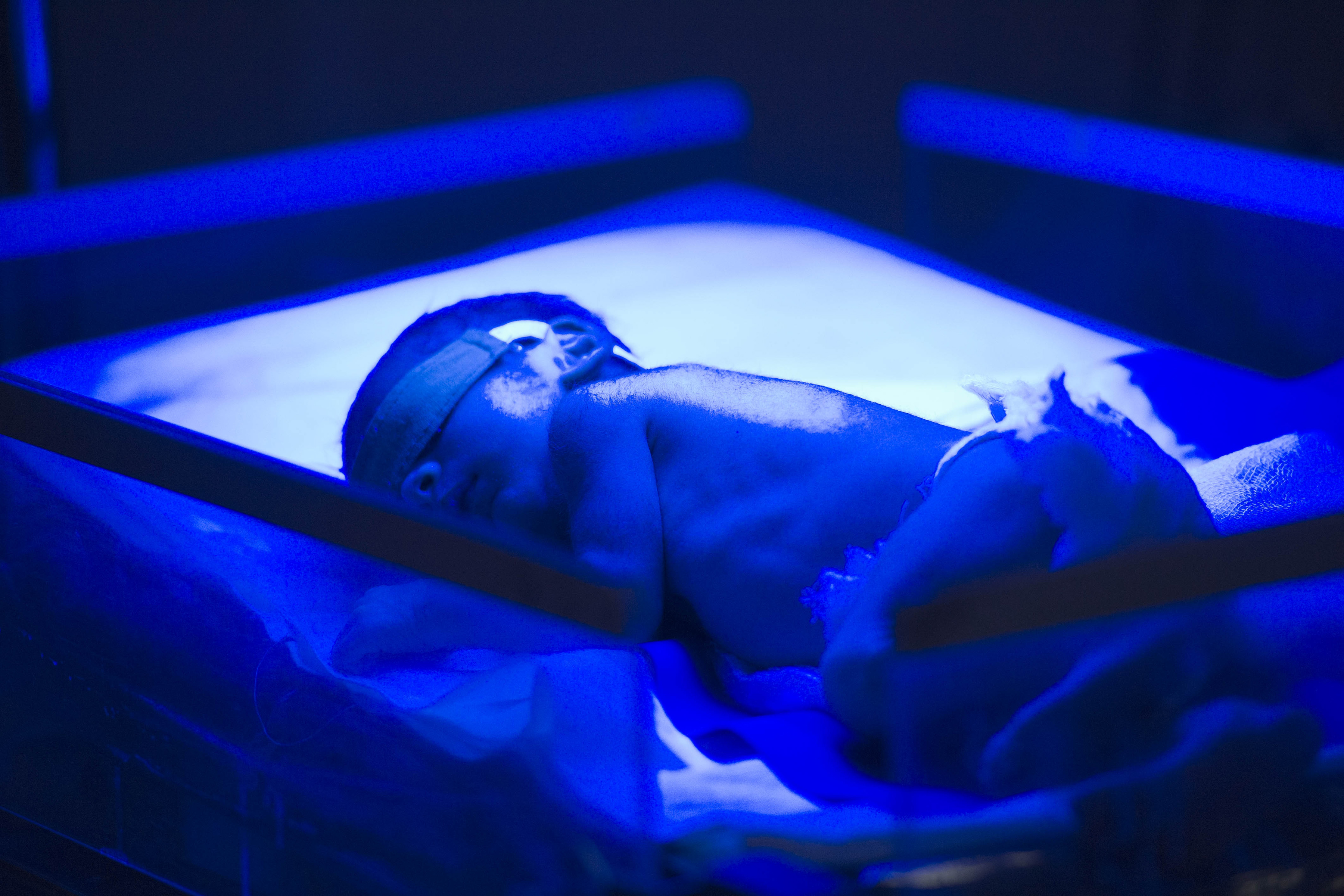 7 Facts About Premature Births You Might Not Have Known
