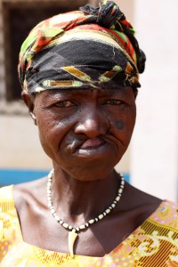 A sexual violence survivor in Paoua, Central African Republic, shows the scars left by a fleeting bullet.