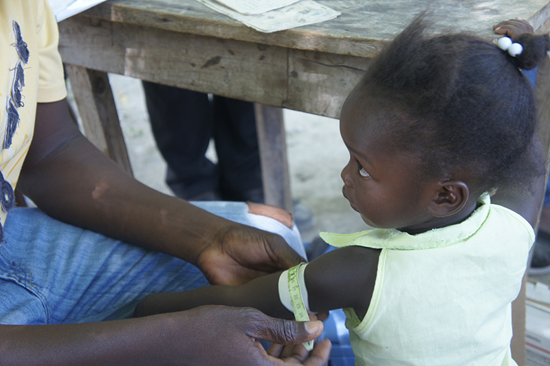 Malnutrition, stunting and the importance of a child’s first 1000 days